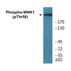 WNK1 (Phospho-Thr58) Colorimetric Cell-Based ELISA Kit