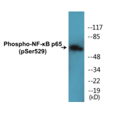 NF-kappaB p65 (Phospho-Ser529) Colorimetric Cell-Based ELISA Kit