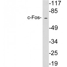 c-Fos Antibody