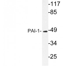 PAI-1 Antibody