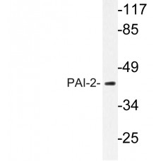 PAI-2 Antibody