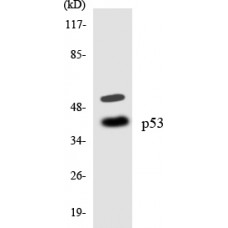 p53 Antibody