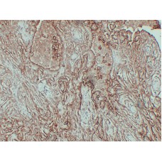 Anti-CA-125  antibody [ABT-MUC16]