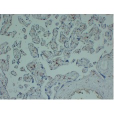 Anti-CD163  antibody [ABT-CD163]
