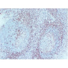 Anti-CD5  antibody [ABT-CD5]