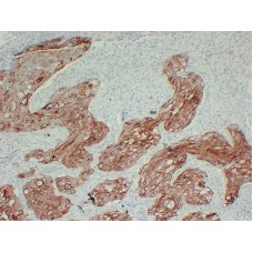 Anti-Cytokeratin 17  antibody [ABT-CK17]