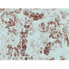 Anti-Cytokeratin 6  antibody [ABT-CK6]