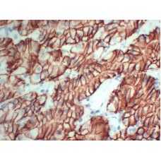 Anti-Claudin 18  antibody [ABT-CLD18]