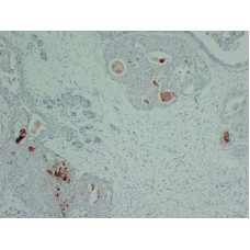Anti-Gross cystic disease fluid protein-15 (GCDFP-15)  antibody [ABT-GCDFP15]