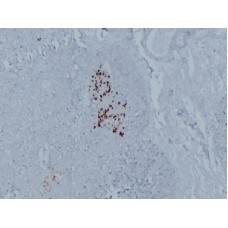 Anti-Glucagon  antibody [ABT-GCG]