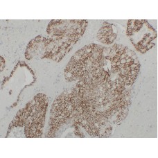 Anti-KSP-Cadherin  antibody [ABT-CDH16]