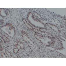 Anti-MutS Protein Homolog 6(MSH6)  antibody [ABT-MSH6]