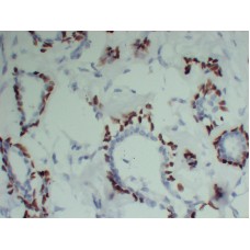 Anti-p63  antibody [ABT-P63]