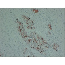 Anti-PIK3CA H1047R  antibody [ABT-PI3.H1047R]