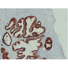 Anti-Prostate-Specific Antigen(PSA)  antibody [ABT-PSA]