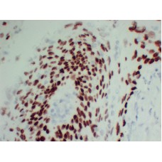 Anti-p40  antibody [ABT-P40]