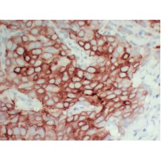 Anti-pS2  antibody [ABT-PS2]