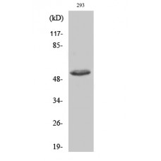 ATF2 (Phospho-Thr73 or 55) Antibody