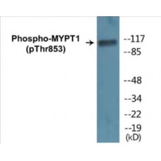 MYPT1 (Phospho-Thr853) Colorimetric Cell-Based ELISA Kit