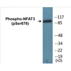 NFAT3 (Phospho-Ser676) Colorimetric Cell-Based ELISA Kit
