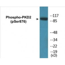 PKD2 (Phospho-Ser876) Colorimetric Cell-Based ELISA Kit
