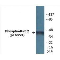 Kir6.2 (Phospho-Thr224) Colorimetric Cell-Based ELISA Kit