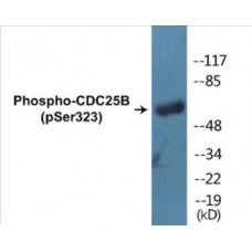 CDC25B (Phospho-Ser323) Colorimetric Cell-Based ELISA Kit