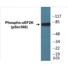 eEF2K (Phospho-Ser366) Colorimetric Cell-Based ELISA Kit