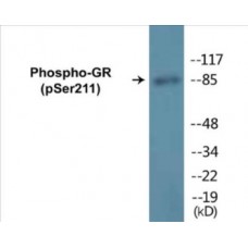 GR (Phospho-Ser211) Colorimetric Cell-Based ELISA Kit