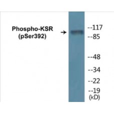 KSR (Phospho-Ser392) Colorimetric Cell-Based ELISA Kit