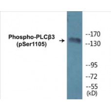 PLCbeta3 (Phospho-Ser1105) Colorimetric Cell-Based ELISA Kit