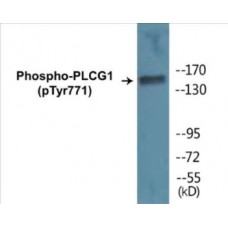 PLCG1 (Phospho-Tyr771) Colorimetric Cell-Based ELISA Kit
