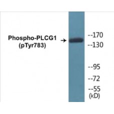 PLCG1 (Phospho-Tyr783) Colorimetric Cell-Based ELISA Kit