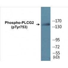 PLCG2 (Phospho-Tyr753) Colorimetric Cell-Based ELISA Kit