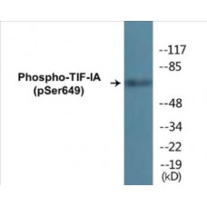 TIF-IA (Phospho-Ser649) Colorimetric Cell-Based ELISA Kit